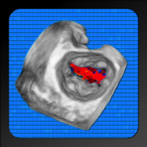 CARDIO3® Atlas of 3D Echocardiography для Мак ОС